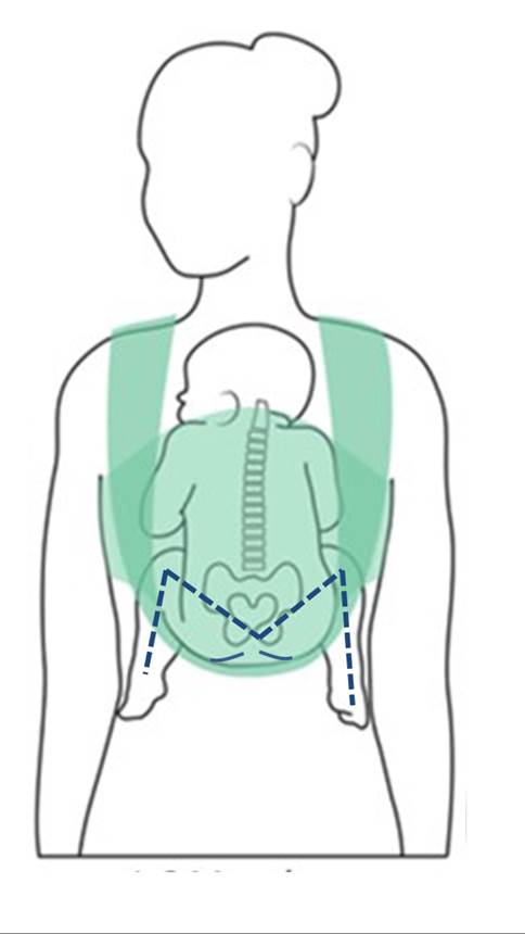 Hip Dysplasia